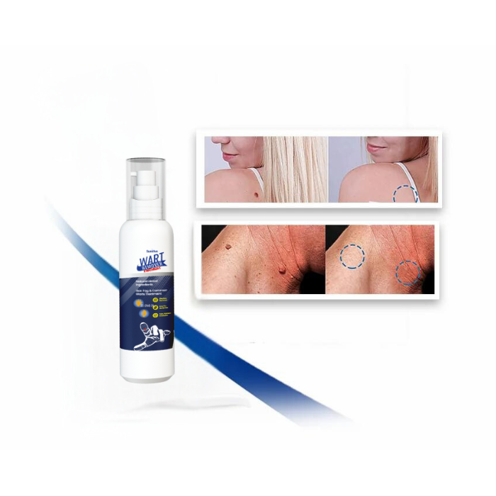 REMOVEDOR DE VERRUGAS WART REMOVER