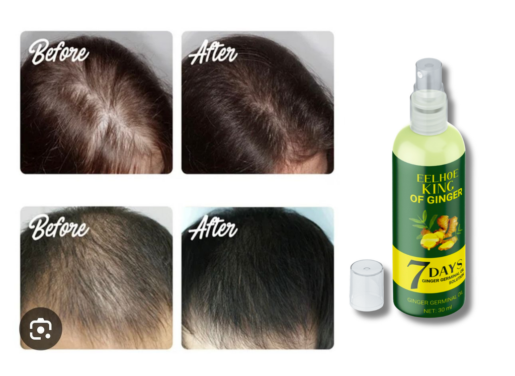 7 DAYS: CRECIMIENTO CAPILAR